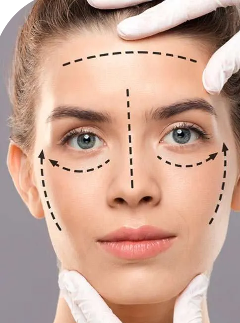 Threadlifting Workshop